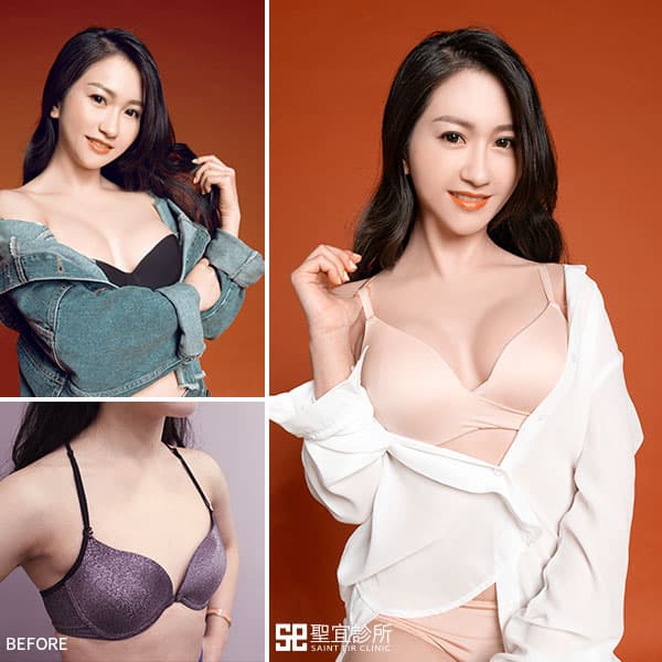 魔滴隆乳．產後媽媽大翻身 躍身性感辣媽咪