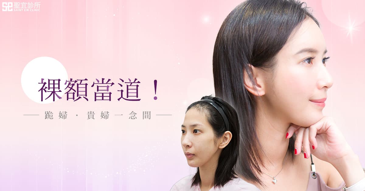 自體脂肪補脂-豐額