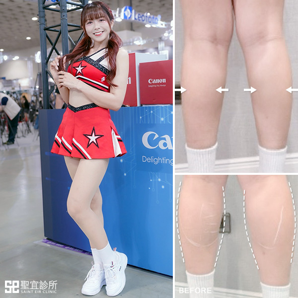 彩虹肉毒．dr林庭伊