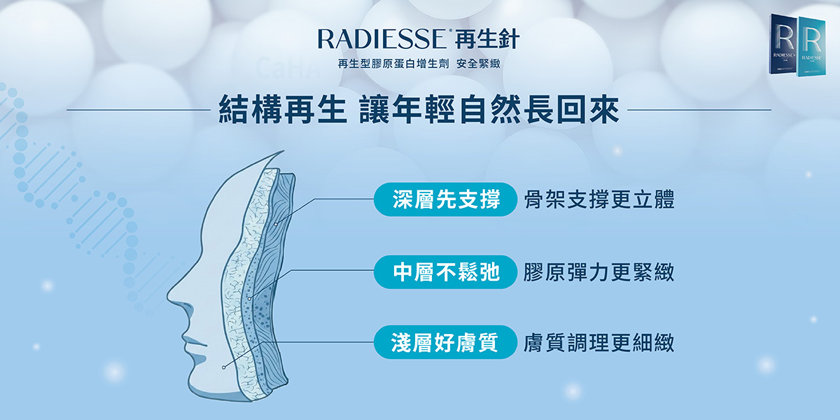 Radiesse再生針(晶亮瓷)-結構再生,讓年輕自然長回來