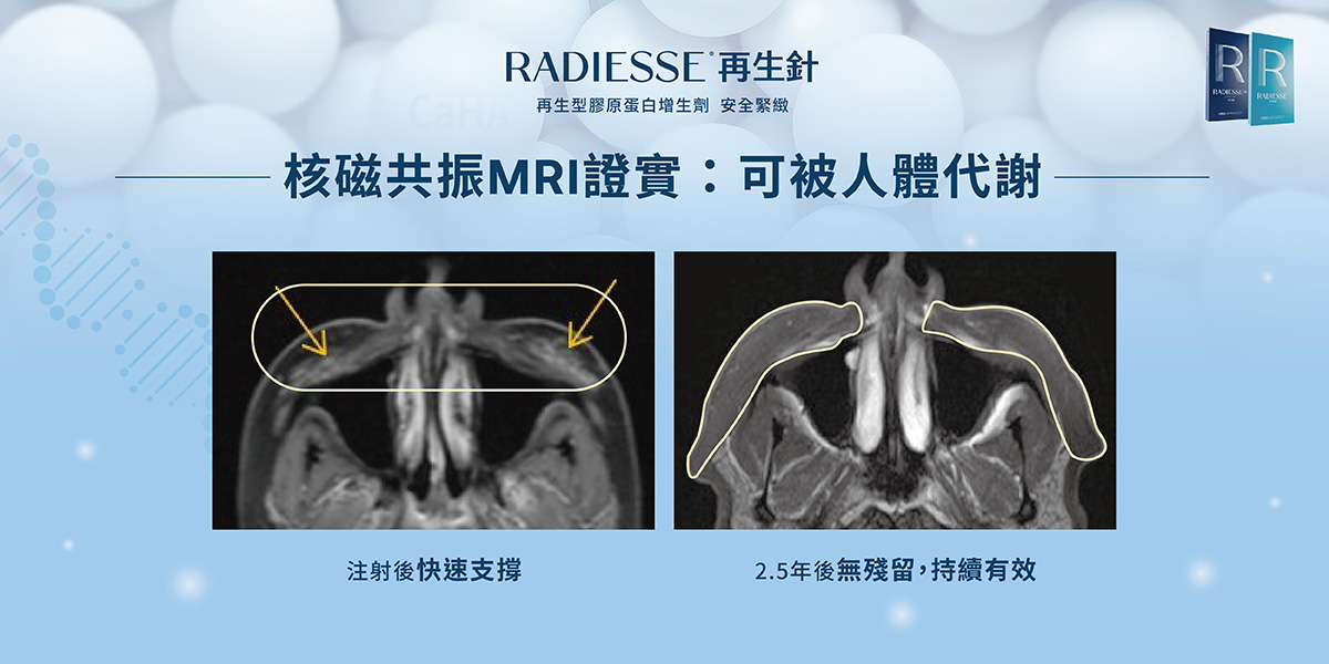 核磁共振MRI證實:可被人體代謝