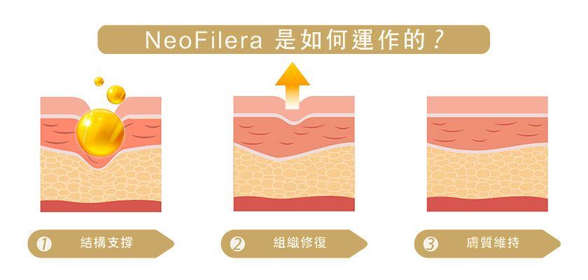 妮芙蕾運作模式
