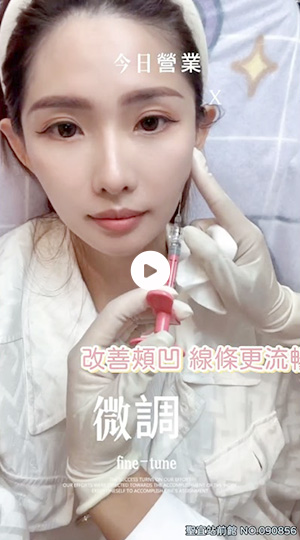 玻尿酸改善