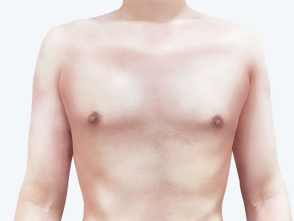 男性女乳