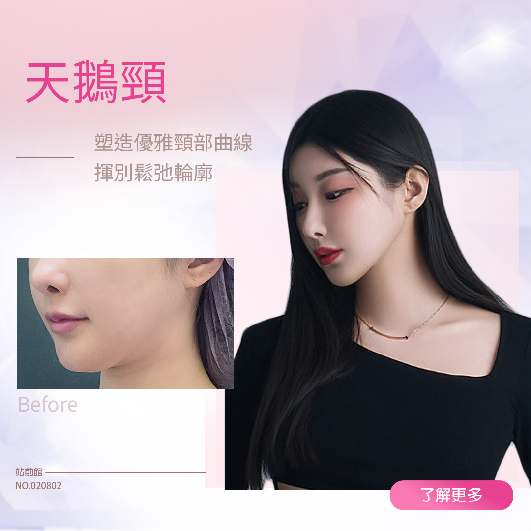 天鵝頸