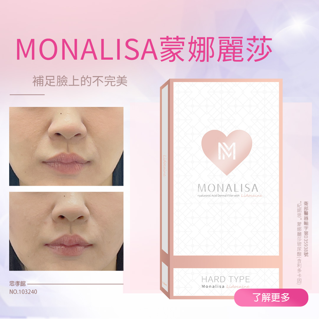 蒙娜麗莎玻尿酸