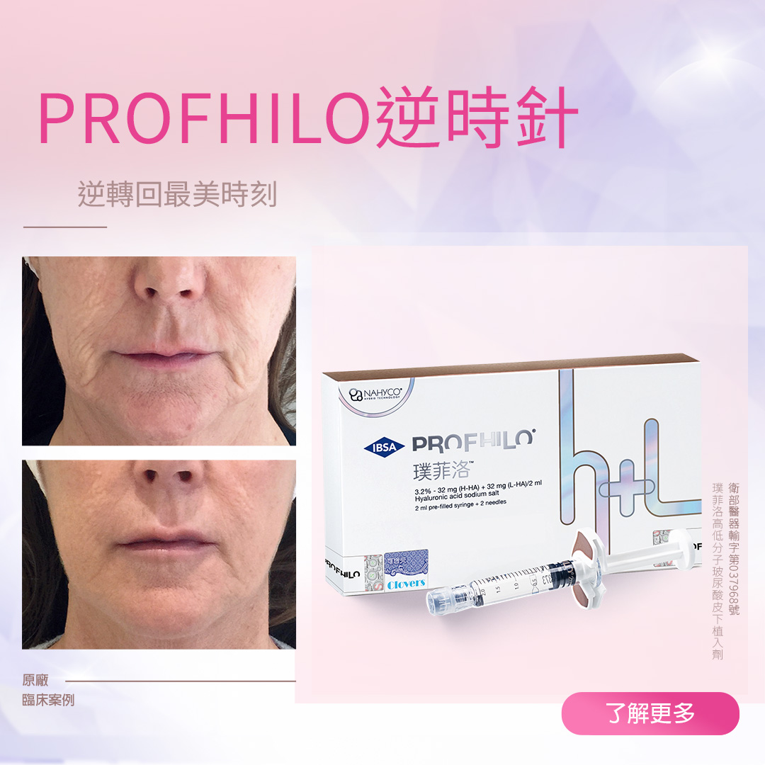 逆時針