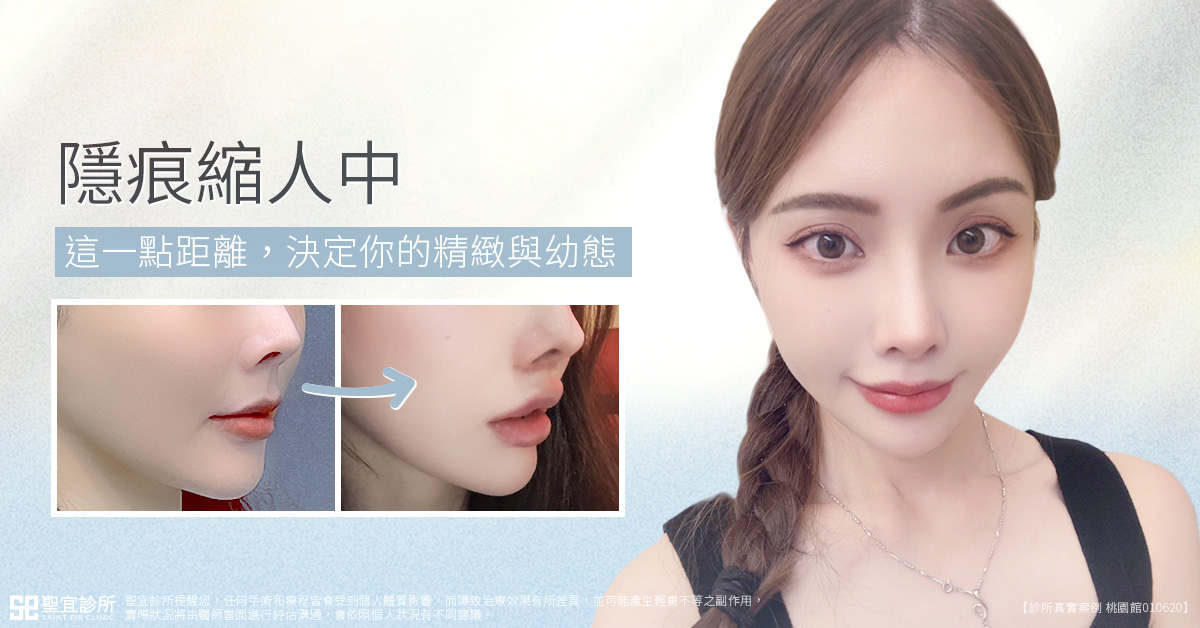 隱痕縮人中手術
